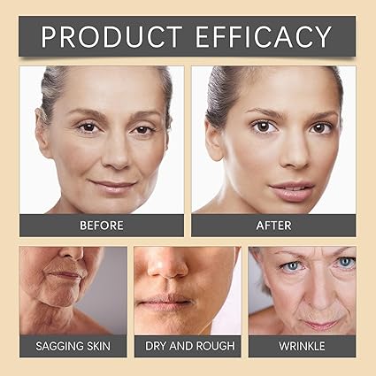OUHOE Bee Venom Anti-Aging Wrinkle Cream (Botox Effect)